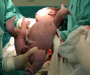 Promueven parto natural en Las Tunas